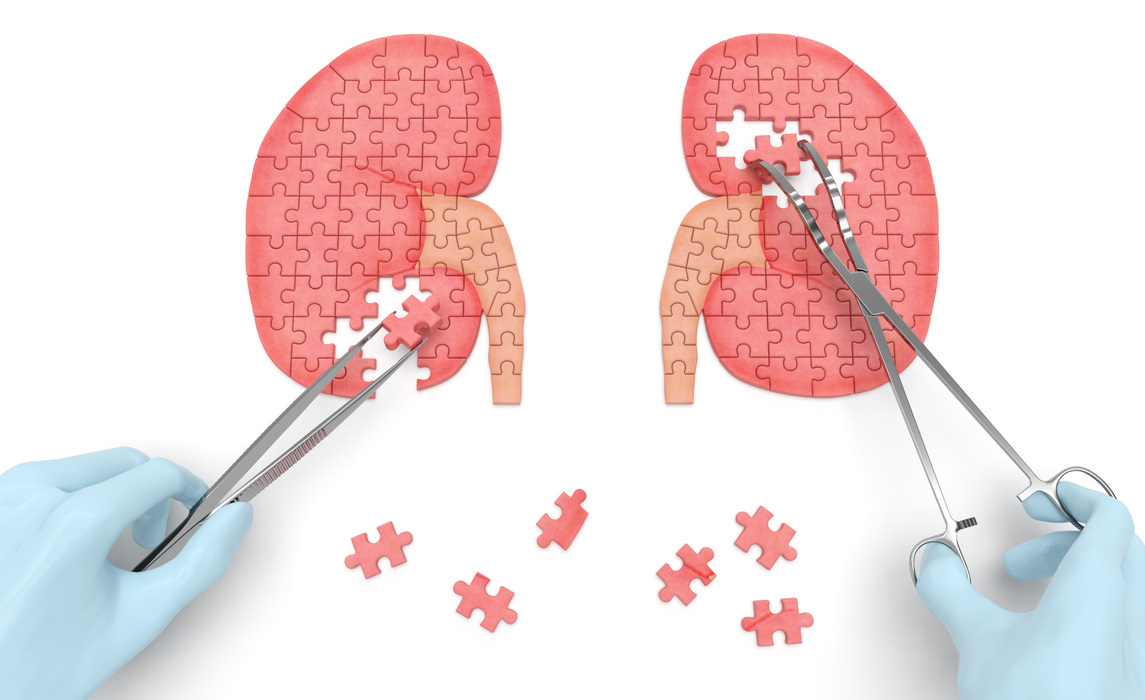 Kidneys operation