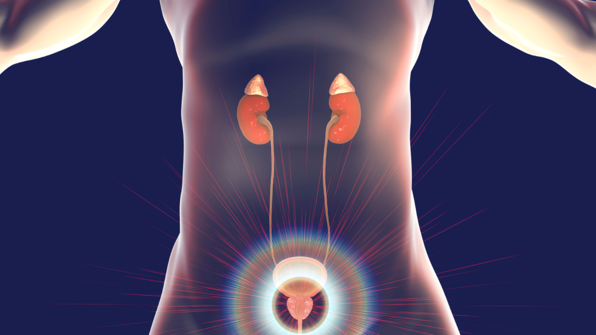 litotrissia laser